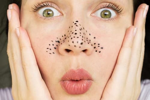 SİYAH NOKTALAR NEDEN OLUR?