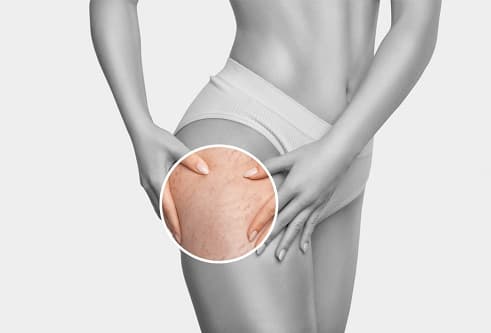 ÇATLAK OLUŞUMUNU ÖNLEMEK MÜMKÜN MÜ?